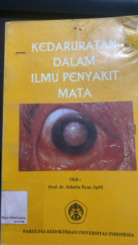 Image of Kedaruratan Dalam Ilmu Penyakit Mata
